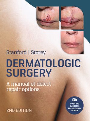 Dermatologic surgery: a manual of defect repair options